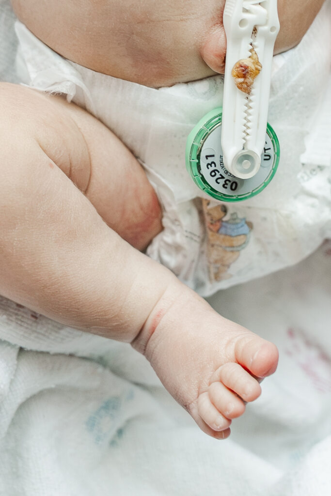 Close-up of baby Ella Jo’s tiny foot and alarm attached to umbilical cord clamp during her Fresh 48 session